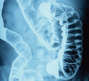 lower_gastrointestinal_contrast_radiography.jpg